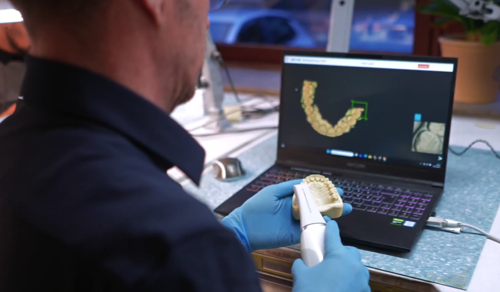 Digitale Abformungen — Zahnersatz Düren, PS Dentaltechnik